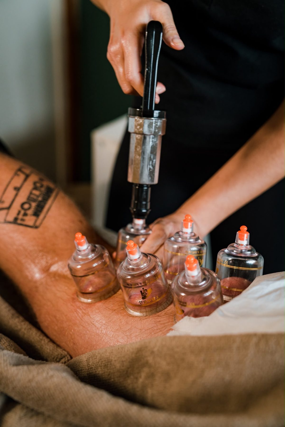 Myofascial cupping, close up