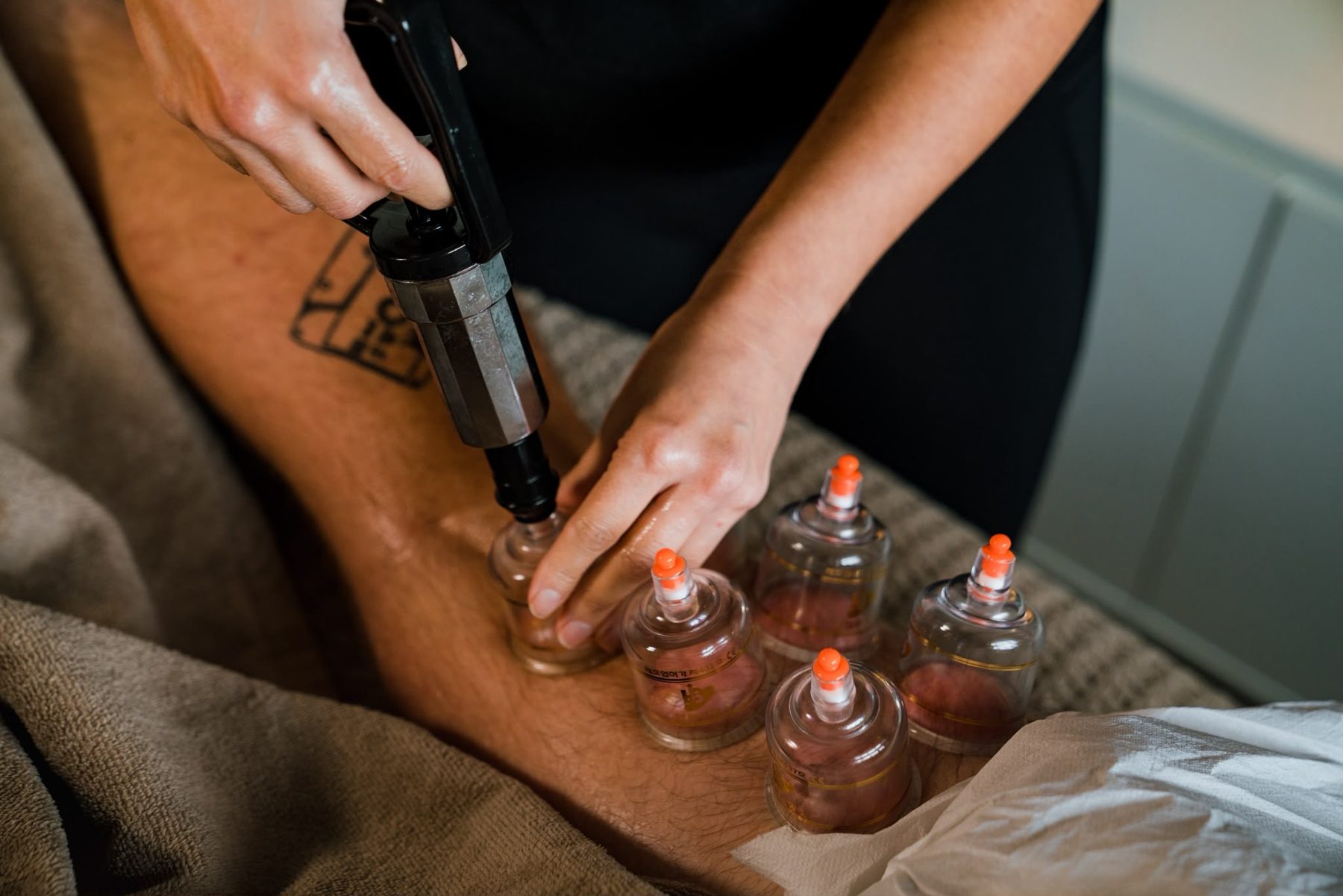 Myofascial cupping on a client's leg